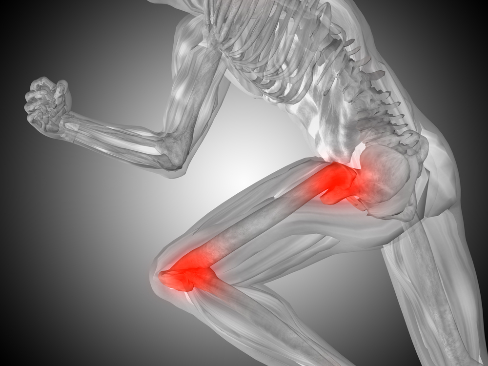 Joint Pain